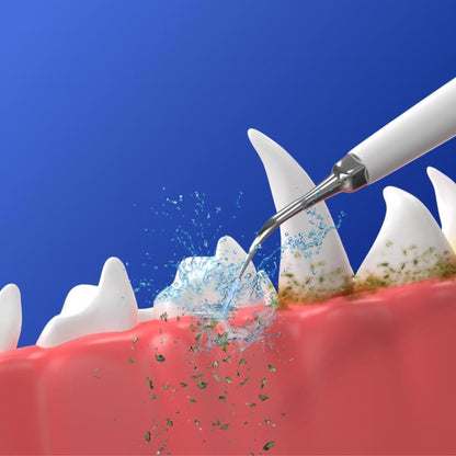 3 Scaler heads + 3 Toothbrush heads - Compatible with Canivet Kit